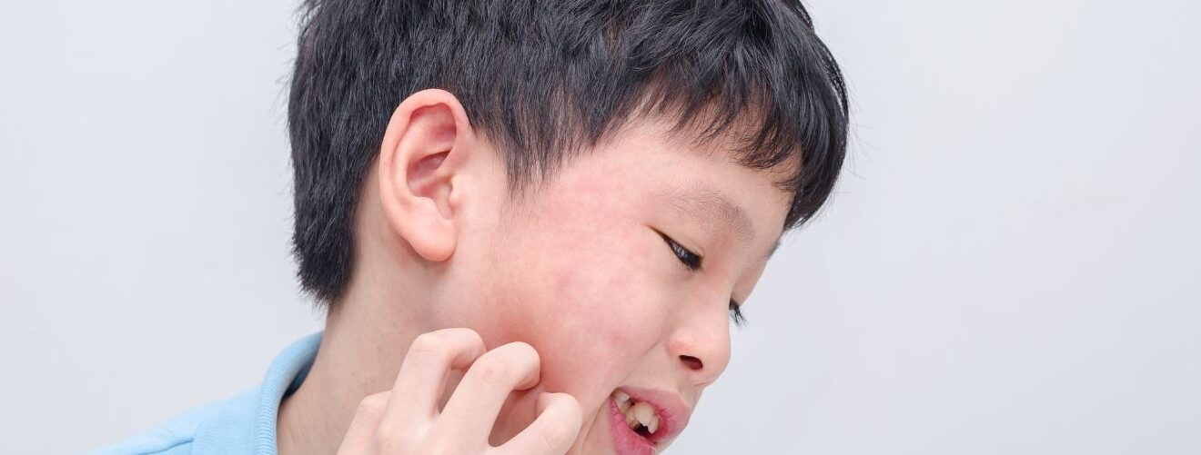 pediatric-skin-concern-sub-banner-3
