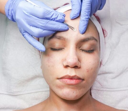 acne-scar-treatment-sub-banner-2
