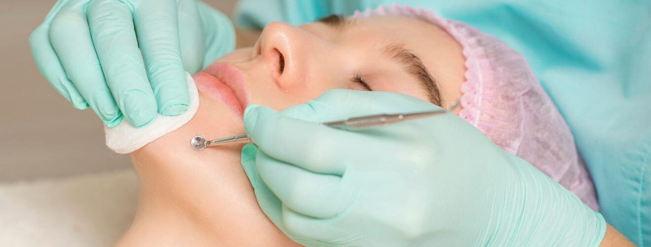 acne-scar-treatment-sub-banner-3