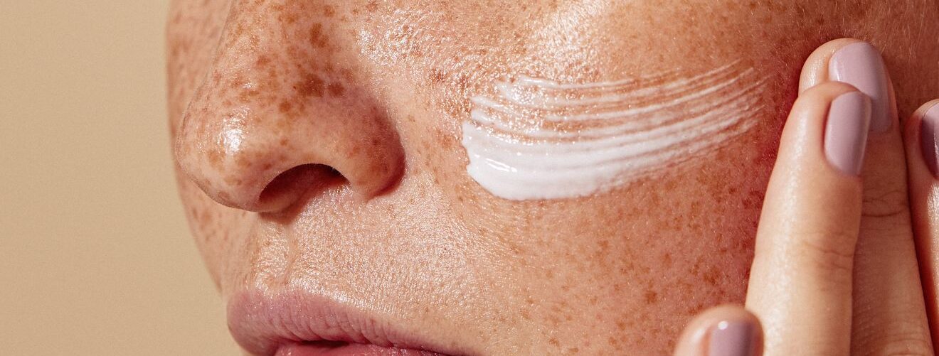 pigmentation-melasma-sub-banner-3