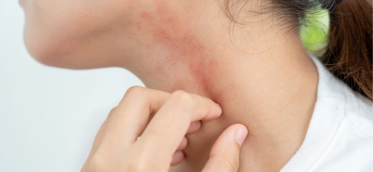 skin-allergy-sub-banner-1