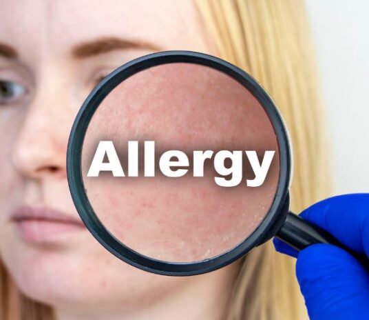 skin-allergy-sub-banner-2