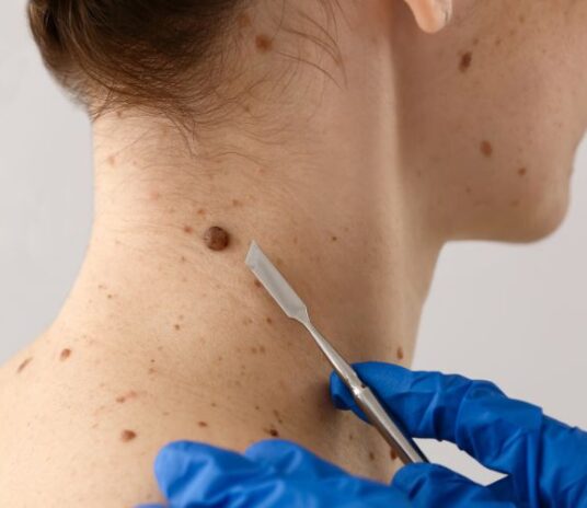 skin-tag-sub-banner-2