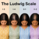 LudWig Scale